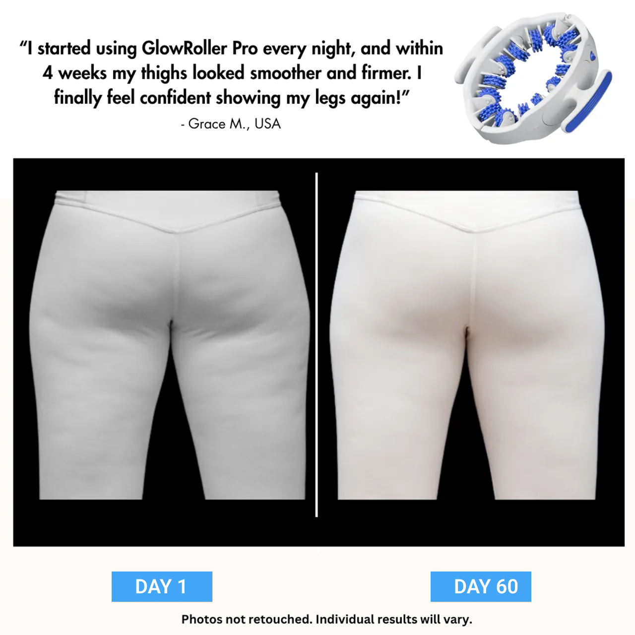 Cozynestly™ - MyoGlide Pro